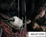 ABLATIONS anagram