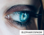 BLEPHAROSPASM anagram