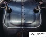 CALLOSITY anagram