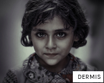 DERMIS anagram