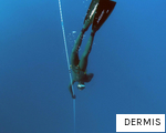 DERMIS anagram