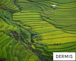 DERMIS anagram