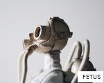 FETUS anagram