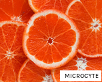MICROCYTE anagram