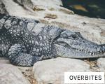 OVERBITES anagram