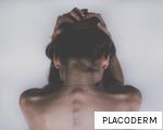 PLACODERM anagram