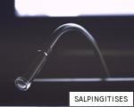 SALPINGITISES anagram