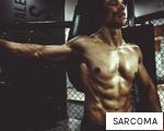 SARCOMA anagram